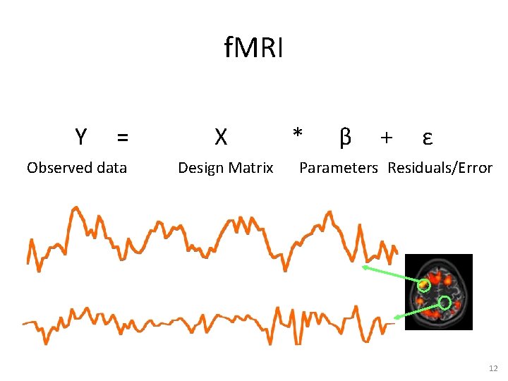 f. MRI Y = Observed data X Design Matrix * β + ε Parameters