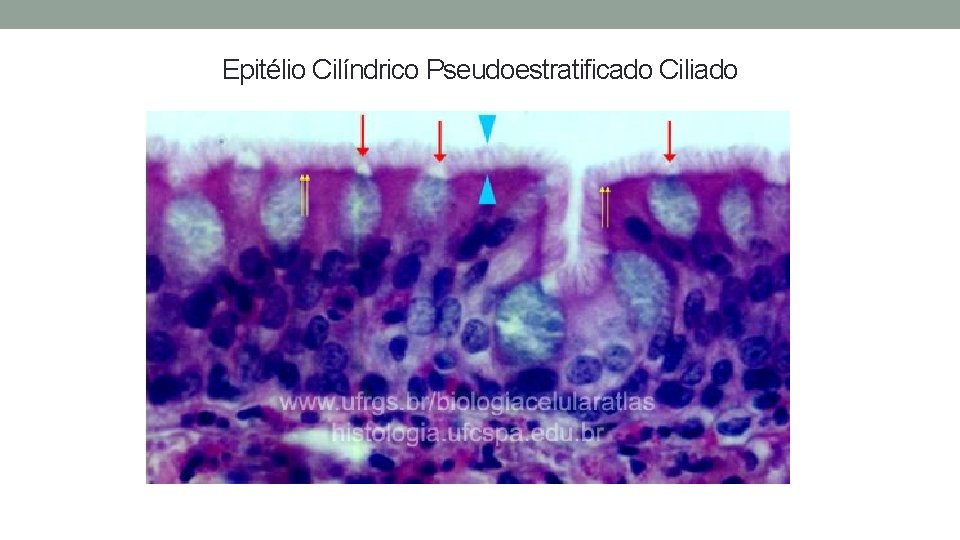 Epitélio Cilíndrico Pseudoestratificado Ciliado Epitélio Cilíndrico Pseudoestratificado Ciliado