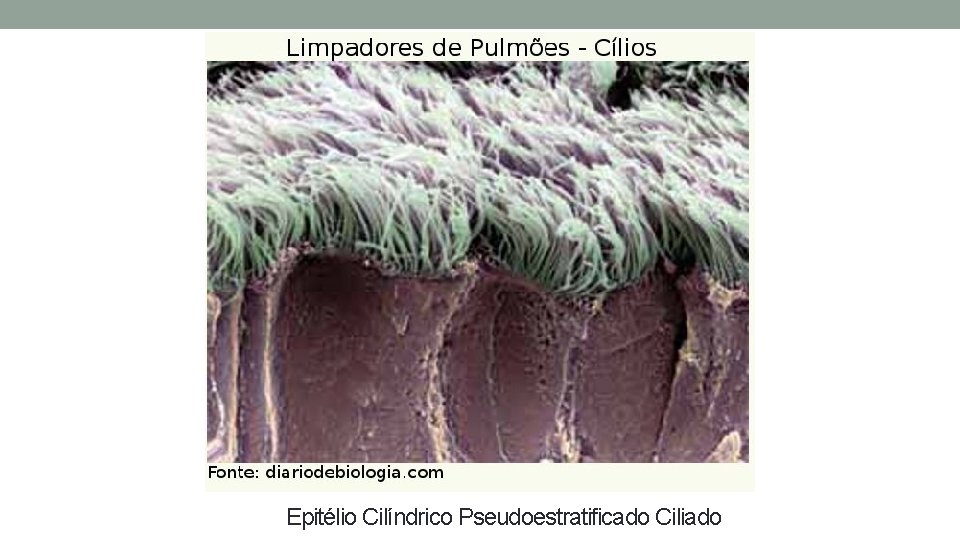 Epitélio Cilíndrico Pseudoestratificado Ciliado Epitélio Cilíndrico Pseudoestratificado Ciliado