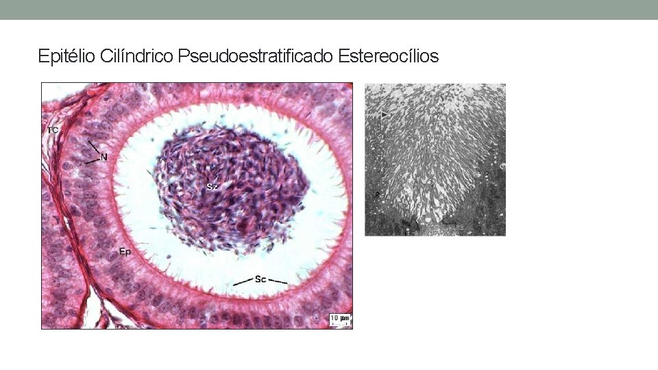 Epitélio Cilíndrico Pseudoestratificado Estereocílios Epitélio Cilíndrico Pseudoestratificado Estereocílios