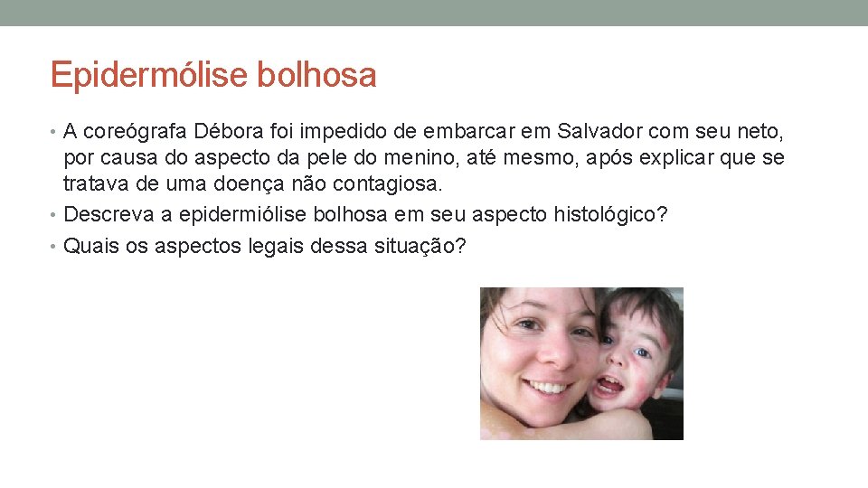Epidermólise bolhosa • A coreógrafa Débora foi impedido de embarcar em Salvador com seu Epidermólise bolhosa • A coreógrafa Débora foi impedido de embarcar em Salvador com seu