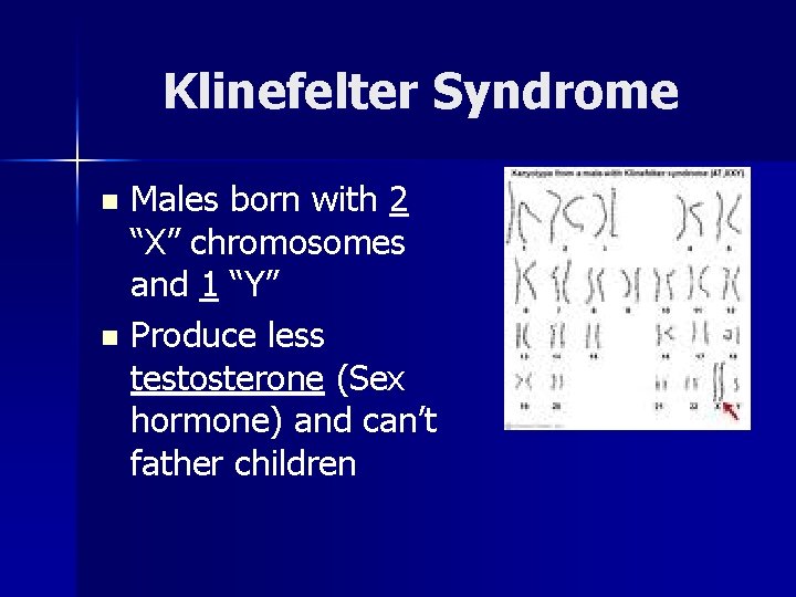 Klinefelter Syndrome Males born with 2 “X” chromosomes and 1 “Y” n Produce less