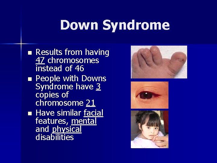 Down Syndrome n n n Results from having 47 chromosomes instead of 46 People