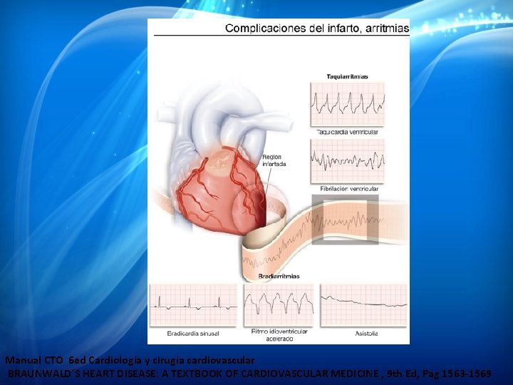 Manual CTO 6 ed Cardiología y cirugía cardiovascular BRAUNWALD´S HEART DISEASE: A TEXTBOOK OF Manual CTO 6 ed Cardiología y cirugía cardiovascular BRAUNWALD´S HEART DISEASE: A TEXTBOOK OF