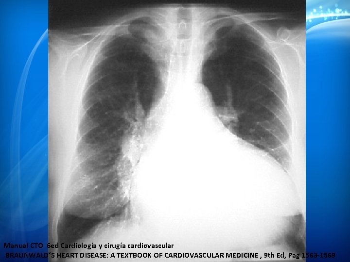 Manual CTO 6 ed Cardiología y cirugía cardiovascular BRAUNWALD´S HEART DISEASE: A TEXTBOOK OF Manual CTO 6 ed Cardiología y cirugía cardiovascular BRAUNWALD´S HEART DISEASE: A TEXTBOOK OF