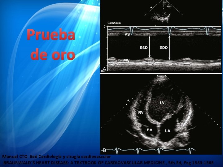 Prueba de oro Manual CTO 6 ed Cardiología y cirugía cardiovascular BRAUNWALD´S HEART DISEASE: Prueba de oro Manual CTO 6 ed Cardiología y cirugía cardiovascular BRAUNWALD´S HEART DISEASE: