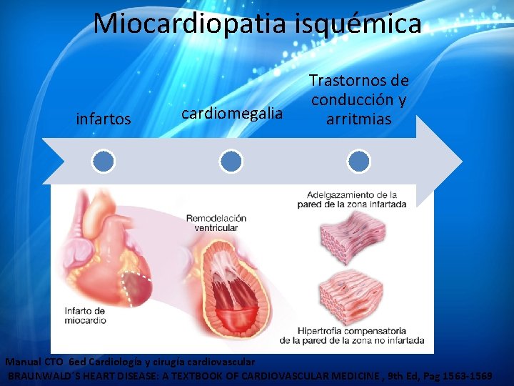 Miocardiopatia isquémica infartos cardiomegalia Trastornos de conducción y arritmias Manual CTO 6 ed Cardiología Miocardiopatia isquémica infartos cardiomegalia Trastornos de conducción y arritmias Manual CTO 6 ed Cardiología