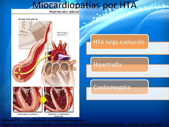 Miocardiopatías por HTA larga evolución Hipertrofia Cardiomegalia Manual CTO 6 ed Cardiología y cirugía Miocardiopatías por HTA larga evolución Hipertrofia Cardiomegalia Manual CTO 6 ed Cardiología y cirugía