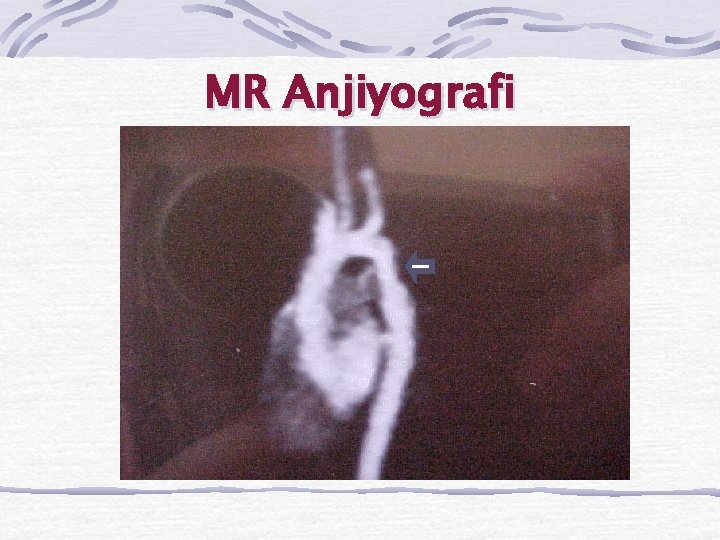 MR Anjiyografi 