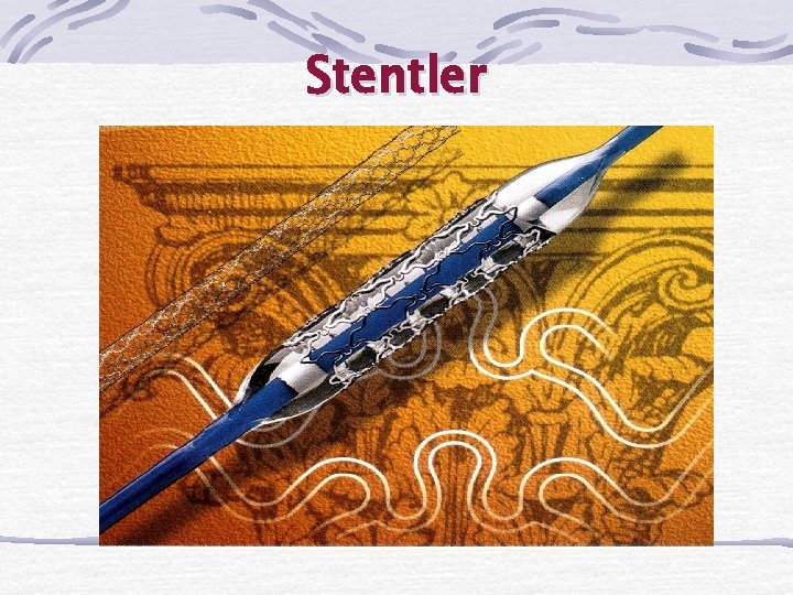 Stentler 