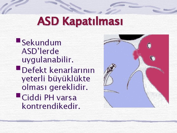 ASD Kapatılması §Sekundum ASD’lerde uygulanabilir. Defekt kenarlarının yeterli büyüklükte olması gereklidir. Ciddi PH varsa