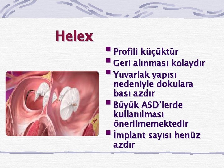 Helex § Profili küçüktür § Geri alınması kolaydır § Yuvarlak yapısı § § nedeniyle