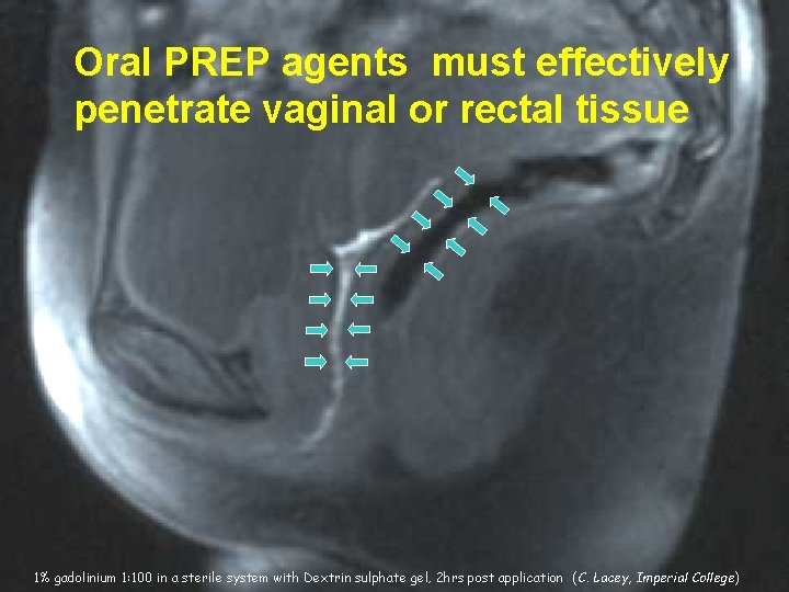 Oral PREP agents must effectively penetrate vaginal or rectal tissue 1% gadolinium 1: 100