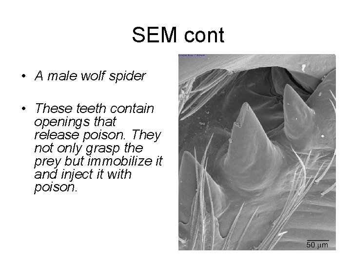 SEM cont • A male wolf spider • These teeth contain openings that release