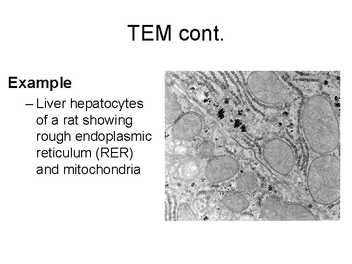 TEM cont. Example – Liver hepatocytes of a rat showing rough endoplasmic reticulum (RER)