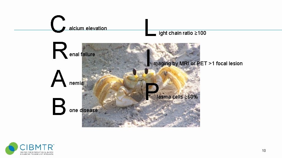 C R A B alcium elevation enal failure L I P ight chain ratio C R A B alcium elevation enal failure L I P ight chain ratio
