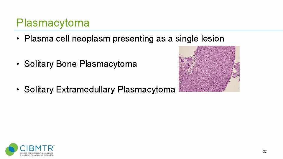 Plasmacytoma • Plasma cell neoplasm presenting as a single lesion • Solitary Bone Plasmacytoma Plasmacytoma • Plasma cell neoplasm presenting as a single lesion • Solitary Bone Plasmacytoma