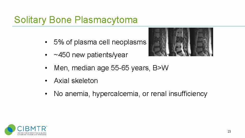 Solitary Bone Plasmacytoma • 5% of plasma cell neoplasms • ~450 new patients/year • Solitary Bone Plasmacytoma • 5% of plasma cell neoplasms • ~450 new patients/year •