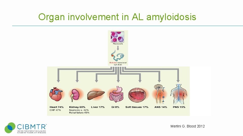 Organ involvement in AL amyloidosis Merlini G. Blood 2012 Organ involvement in AL amyloidosis Merlini G. Blood 2012