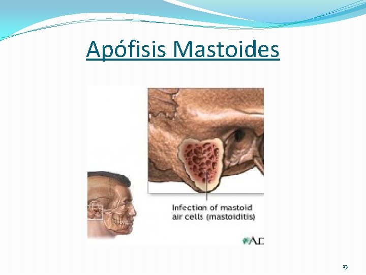 Apófisis Mastoides 13 