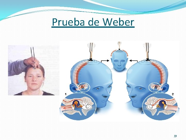 Prueba de Weber 33 