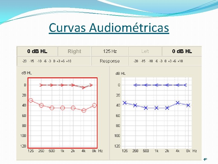 Curvas Audiométricas 40 