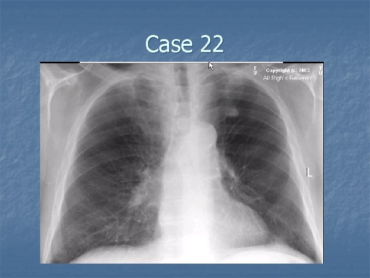 Case 22 