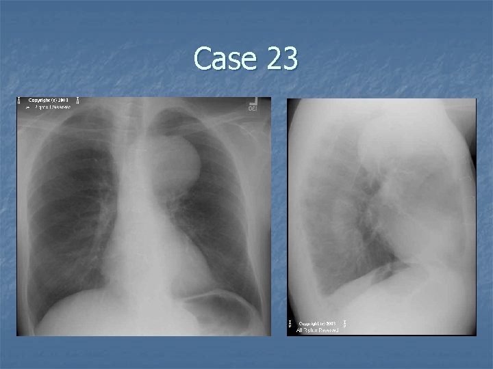 Case 23 