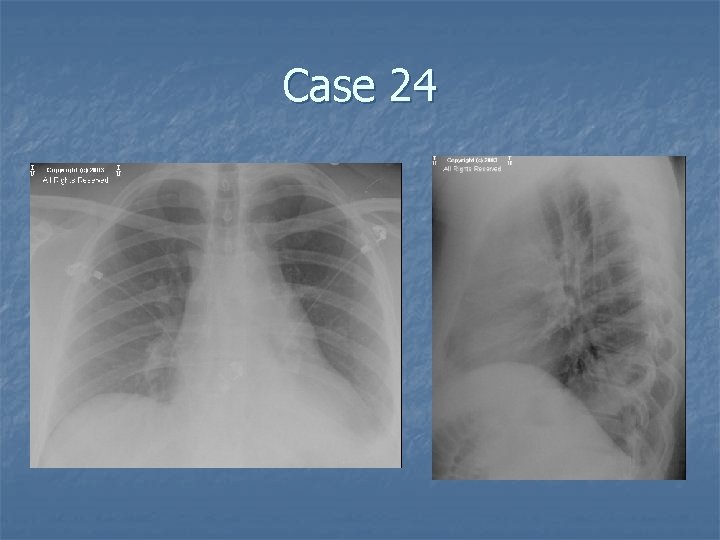 Case 24 