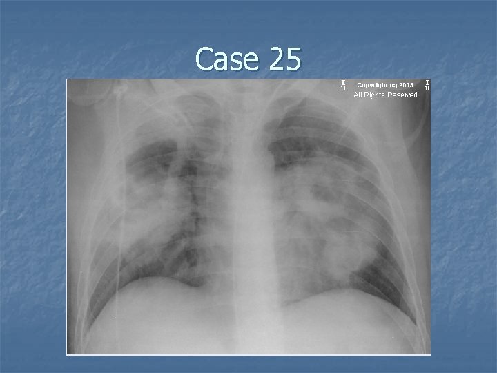 Case 25 