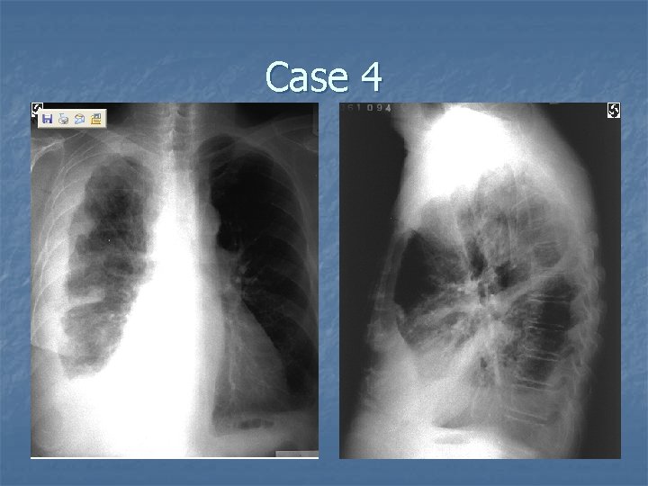 Case 4 