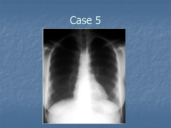 Case 5 