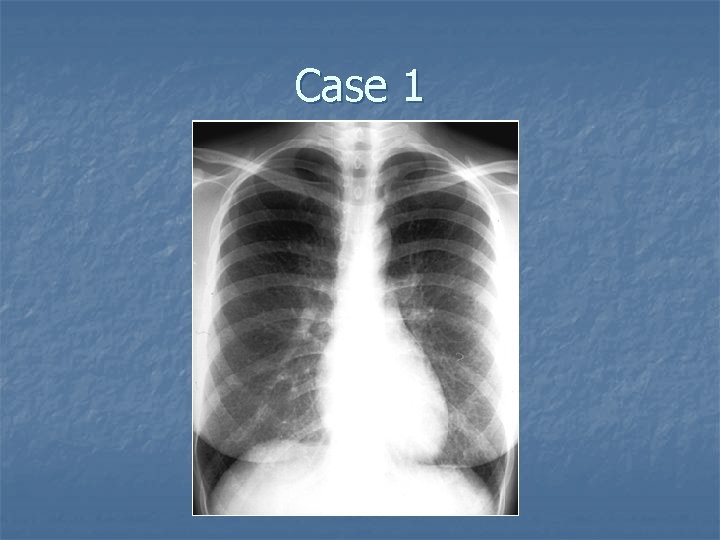 Case 1 