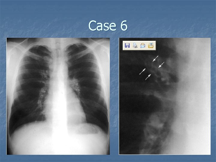 Case 6 