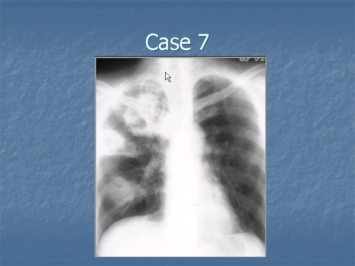 Case 7 