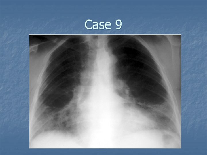 Case 9 