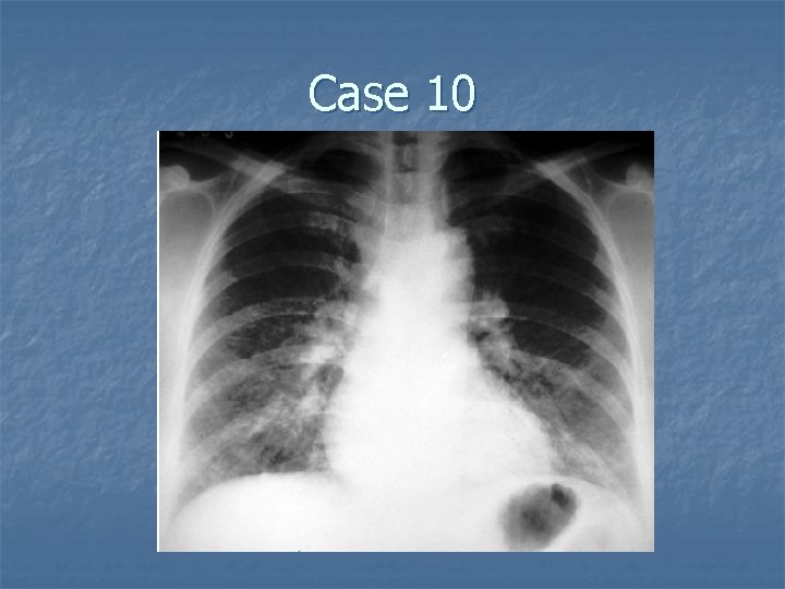 Case 10 