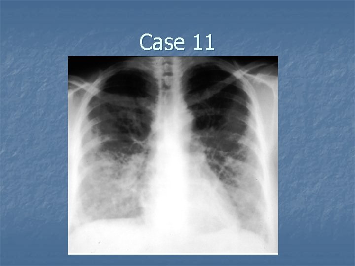 Case 11 