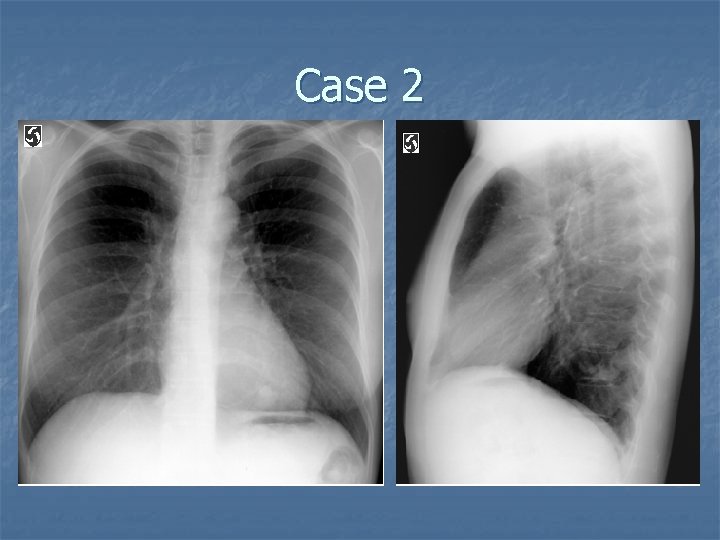 Case 2 