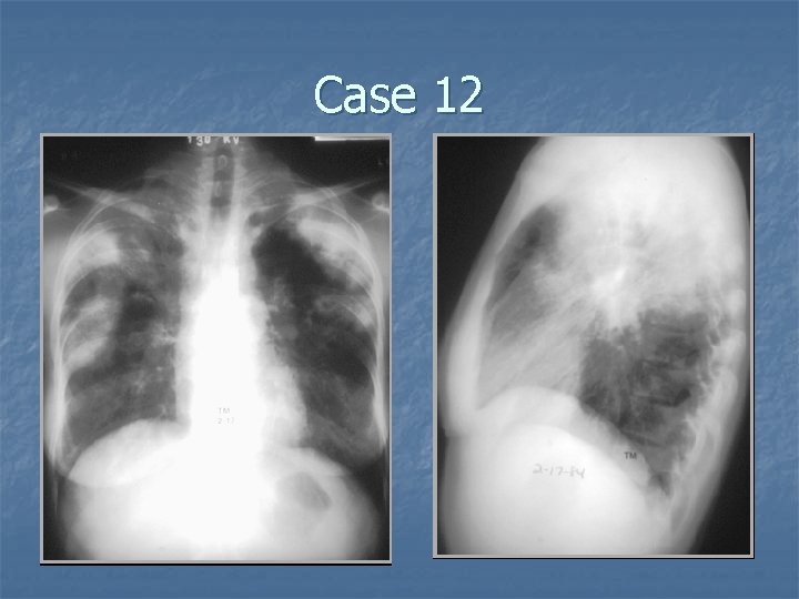 Case 12 
