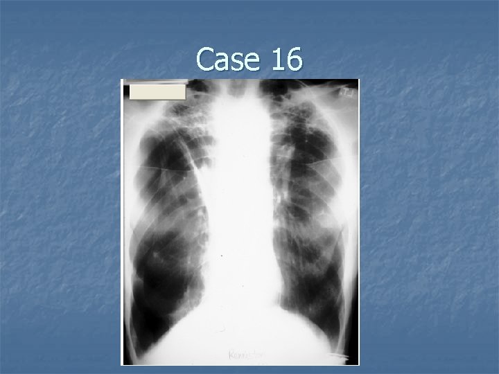 Case 16 