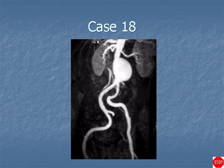 Case 18 