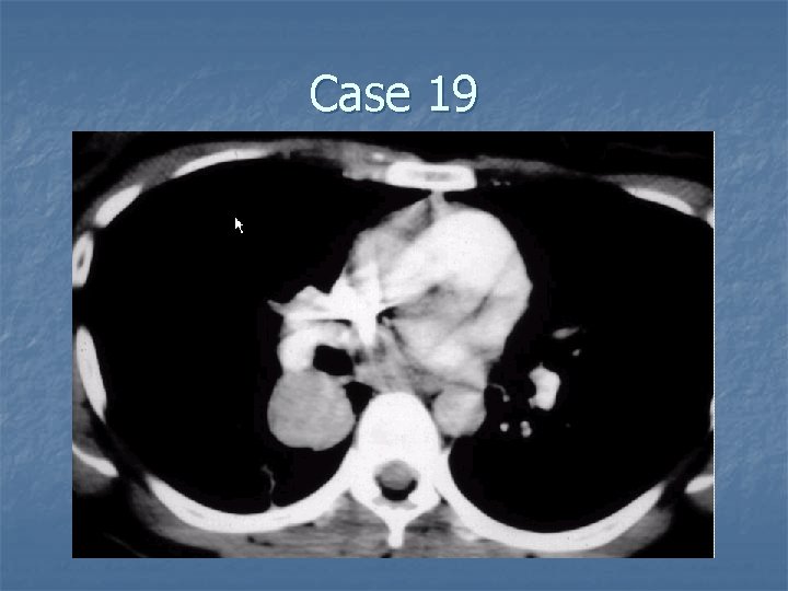 Case 19 