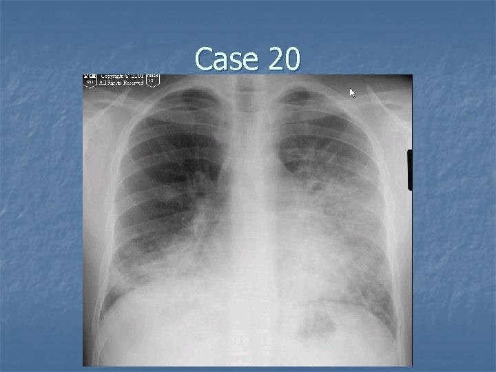 Case 20 