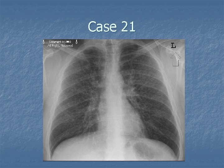 Case 21 