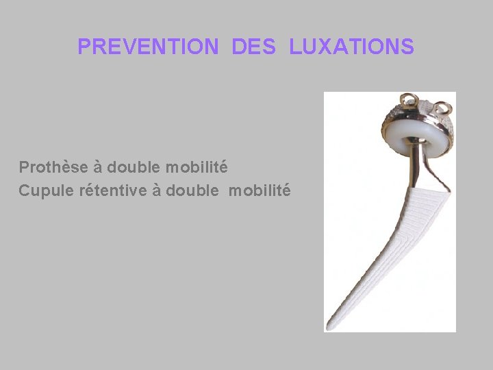 PREVENTION DES LUXATIONS Prothèse à double mobilité Cupule rétentive à double mobilité 