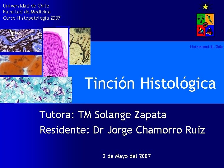 Universidad de Chile Facultad de Medicina Curso Histopatología 2007 Tinción Histológica Tutora: TM Solange