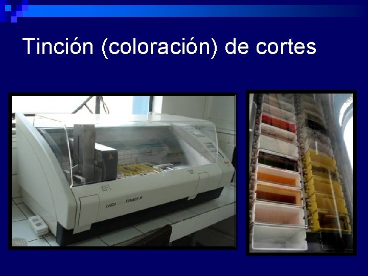 Tinción (coloración) de cortes 