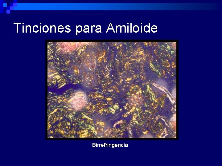 Tinciones para Amiloide Birrefringencia 
