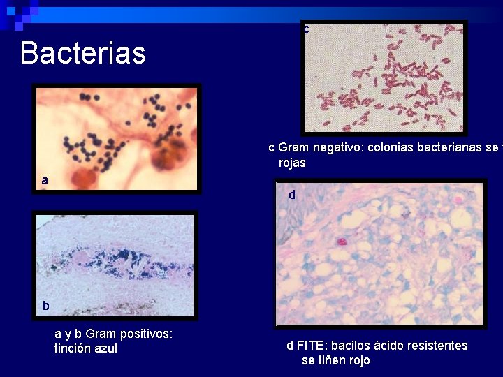c Bacterias c Gram negativo: colonias bacterianas se t rojas a d b a
